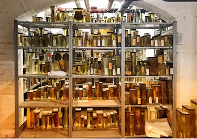 Metal shelves densely packed with preserved tissue specimens of various sizes, all suspended in glass containers. Metal shelves densely packed with preserved tissue specimens of various sizes, all suspended in glass containers.